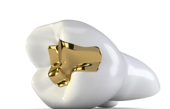 歯科衛生士による専門ケア