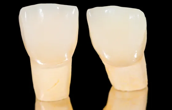 すき間を整えるラミネートベニア・フルマウス形成